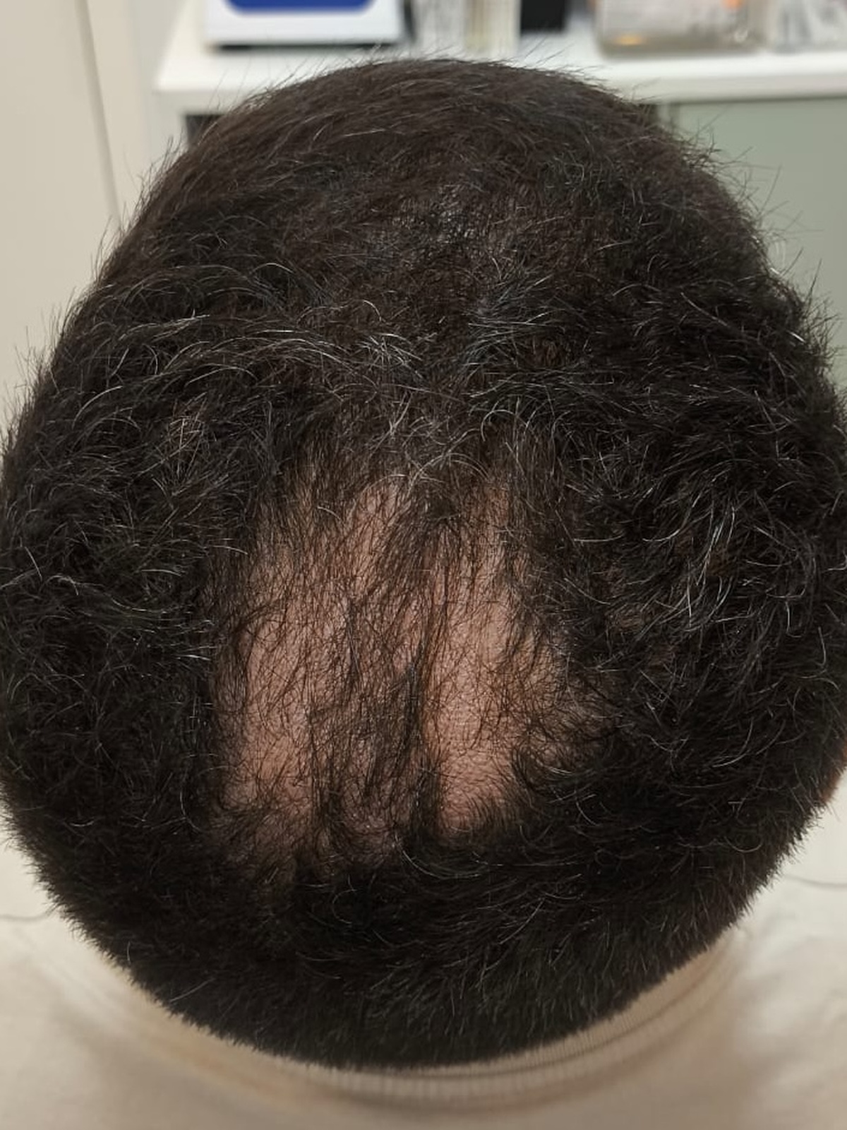 Antes